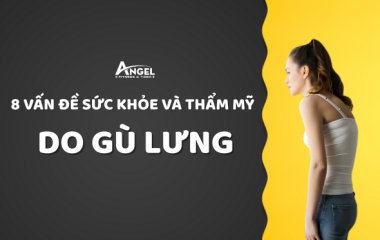 BẠN CÓ ĐANG GÙ LƯNG? 8 VẤN ĐỀ VỀ SỨC KHỎE VÀ THẨM MỸ DO GÙ LƯNG